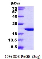 3?g Human OMP protein (GTX57529-pro) by SDS-PAGE under reducing condition and visualized by coomassie blue stain.