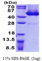 3microg Human FLJ11506 protein (GTX57538-pro) by SDS-PAGE under reducing condition and visualized by coomassie blue stain. 3microg Human FLJ11506 protein (GTX57538-pro) by SDS-PAGE under reducing condition and visualized by coomassie blue stain.