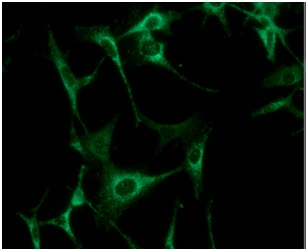 ICC/IF analysis of U87-MG cells using GTX57541 AK3 antibody. Blue: DAPI Green: Primary antibody Dilution: 1:100