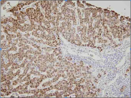 IHC-P analysis of Human liver tissue using GTX57541 AK3 antibody. Dilution: 1:100