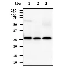 WB analysis of various samples using GTX57541 AK3 antibody. Lane 1 : Hep3B whole cell lysate Lane 2 : 293T whole cell lysate Lane 3 : Mouse kidney tissue lysate Loading : 40 microg Dilution : 1:1000