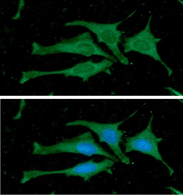 ICC/IF analysis of HeLa cells using GTX57543 Calmodulin antibody. Blue: DAPI Green: Primary antibody Dilution: 1:100