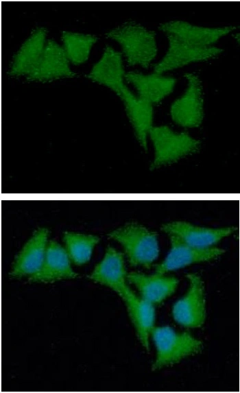 ICC/IF analysis of HeLa cells using GTX57544 alpha B Crystallin antibody. Blue: DAPI Green: Primary antibody Dilution: 1:100 ICC/IF analysis of HeLa cells using GTX57544 alpha B Crystallin antibody. Blue: DAPI Green: Primary antibody Dilution: 1:100