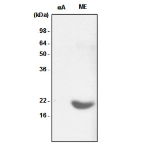 WB analysis of various samples using GTX57544 alpha B Crystallin antibody. Samples : Recombinant Human crystallin alpha A (alphaA) and Mouse eye tissue lysate (ME) Dilution : 1:1000