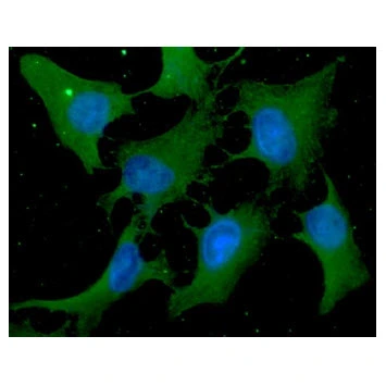 ICC/IF analysis of HeLa cells using GTX57545 Cofilin 1 antibody. Blue: DAPI Green: Primary antibody Dilution: 1:100