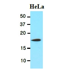 WB analysis of HeLa whole cell lysate using GTX57545 Cofilin 1 antibody. Loading : 20 microg Dilution : 1:1000