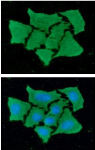 ICC/IF analysis of HeLa cells using GTX57547 FABP4 antibody. Blue: DAPI Green: Primary antibody Dilution: 1:100 ICC/IF analysis of HeLa cells using GTX57547 FABP4 antibody. Blue: DAPI Green: Primary antibody Dilution: 1:100