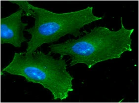 ICC/IF analysis of HeLa cells using GTX57548 GSK3 beta antibody. Blue: DAPI Green: Primary antibody Dilution: 1:100