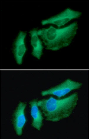 ICC/IF analysis of HeLa cells using GTX57550 HSP27 antibody. Blue: DAPI Green: Primary antibody Dilution: 1:100