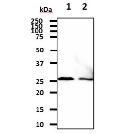WB analysis of various samples using GTX57550 HSP27 antibody. Lane 1 : A431 whole cell lysate Lane 2 : HepG2 whole cell lysate Loading : 40 microg Dilution : 1:1000