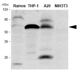 WB analysis of various samples using GTX57552 IRF5 antibody. Samples : Ramos, THP-1, A20 and NIH-3T3 whole cell lysate Dilution : 1:1000