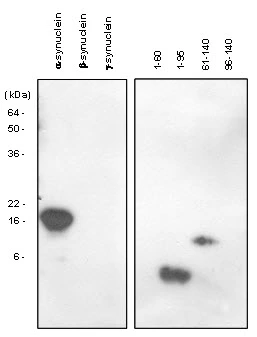 WB analysis of various samples using GTX57554 alpha Synuclein antibody. Samples : Recombinant Human protein of synuclein family (alpha-, beta- and gamma-) and alpha-synuclein domains (1-60, 1-95, 61-140 and 96-140) Dilution : 1:1000 WB analysis of various samples using GTX57554 alpha Synuclein antibody. Samples : Recombinant Human protein of synuclein family (alpha-, beta- and gamma-) and alpha-synuclein domains (1-60, 1-95, 61-140 and 96-140) Dilution : 1:1000