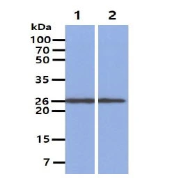 WB analysis of various samples using GTX57556 PGP9.5 antibody. Lane 1 : Mouse Brain lysate Lane 2 : U87-MG whole cell lysate Loading : 40 microg Dilution : 1:1000 WB analysis of various samples using GTX57556 PGP9.5 antibody. Lane 1 : Mouse Brain lysate Lane 2 : U87-MG whole cell lysate Loading : 40 microg Dilution : 1:1000