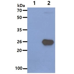 WB analysis of various samples using GTX57559 SNAP25 antibody. Lane 1 : 293T cell lysate Lane 2 : SNAP25 transfected 293T cell lysate Loading : 10 microg Dilution : 1:3000