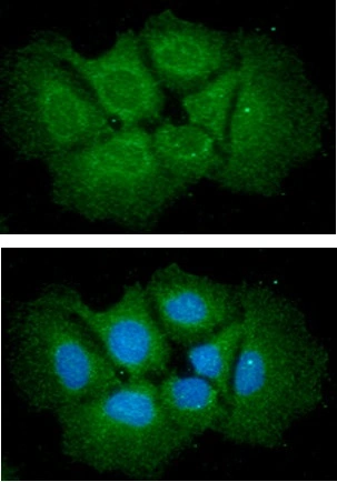 ICC/IF analysis of Hep3B cells using GTX57562 IL6 antibody. Blue: DAPI Green: Primary antibody Dilution: 1:100