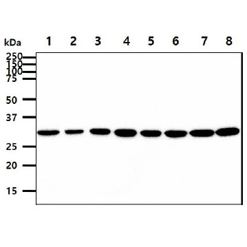 WB analysis of various samples using GTX57562 IL6 antibody. Lane 1 : HeLa whole cell lysate Lane 2 : HepG2 whole cell lysate Lane 3 : Raw264.7 whole cell lysate Lane 4 : PC-3 whole cell lysate Lane 5 : THP-1 whole cell lysate Lane 6 : A549 whole cell lysate Lane 7 : MCF-7 whole cell lysate Lane 8 : K562 whole cell lysate Loading : 40 microg Dilution : 1:1000