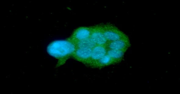 ICC/IF analysis of MCF7 cells using GTX57564 OSTF1 antibody. Blue: DAPI Green: Primary antibody Dilution: 1:100