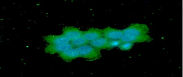 ICC/IF analysis of A431 cells using GTX57564 OSTF1 antibody. Blue: DAPI Green: Primary antibody Dilution: 1:100