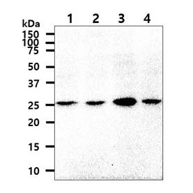 WB analysis of various samples using GTX57564 OSTF1 antibody. Lane 1 : HepG2 whole cell lysate Lane 2 : MCF-7 whole cell lysate Lane 3 : Jurkat whole cell lysate Lane 4 : LNCap whole cell lysate Loading : 40 microg Dilution : 1:1000