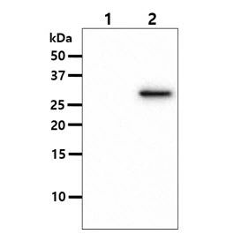 WB analysis of various samples using GTX57564 OSTF1 antibody. Lane 1 : 293T cell lysate Lane 2 : OSTF1 (1-217aa) transfected 293T cell lysate Loading : 10 microg Dilution : 1:1000
