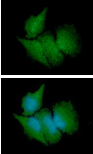 ICC/IF analysis of HeLa cells using GTX57565 CBR3 antibody. Blue: DAPI Green: Primary antibody Dilution: 1:100 ICC/IF analysis of HeLa cells using GTX57565 CBR3 antibody. Blue: DAPI Green: Primary antibody Dilution: 1:100