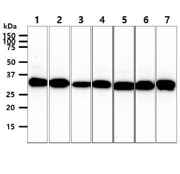WB analysis of various samples using GTX57565 CBR3 antibody. Lane 1 : HepG2 whole cell lysate Lane 2 : HeLa whole cell lysate Lane 3 : 293T whole cell lysate Lane 4 : MCF-7 whole cell lysate Lane 5 : A549 whole cell lysate Lane 6 : SW480 whole cell lysate Lane 7 : Mouse brain tissue lysate Loading : 40 microg Dilution : 1:1000