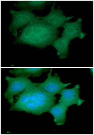 ICC/IF analysis of MCF7 cells using GTX57566 ADRM1 antibody. Blue: DAPI Green: Primary antibody Dilution: 1:100