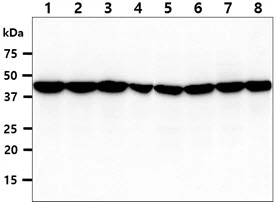 WB analysis of various samples using GTX57566 ADRM1 antibody. Lane 1 : MCF-7 whole cell lysate Lane 2 : HeLa whole cell lysate Lane 3 : K562 whole cell lysate Lane 4 : PC-3 whole cell lysate Lane 5 : 293T whole cell lysate Lane 6 : HepG2 whole cell lysate Lane 7 : Jurkat whole cell lysate Lane 8 : U87-MG whole cell lysate Loading : 40 microg Dilution : 1:1000