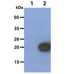 WB analysis of various samples using GTX57569 RBP4 antibody. Lane 1 : 293T cell lysate Lane 2 : RBP4 transfected 293T cell lysate Loading : 10 microg Dilution : 1:500