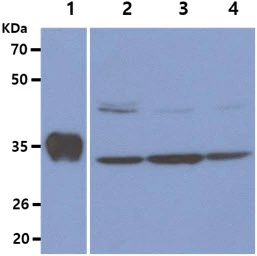 WB analysis of various samples using GTX57572 Thymidylate synthase antibody. Lane 1 : Recombinant Human Thymidylate synthase protein (50 ng) Lane 2 : HeLa whole cell lysate (40 microg) Lane 3 : Jurkat whole cell lysate (40 microg) Lane 4 : MCF-7 whole cell lysate (40 microg)