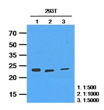 WB analysis of 293T whole cell lysate using GTX57578 HPRT antibody. Loading : 35 microg Dilution : 1:500~1:5000 WB analysis of 293T whole cell lysate using GTX57578 HPRT antibody. Loading : 35 microg Dilution : 1:500~1:5000