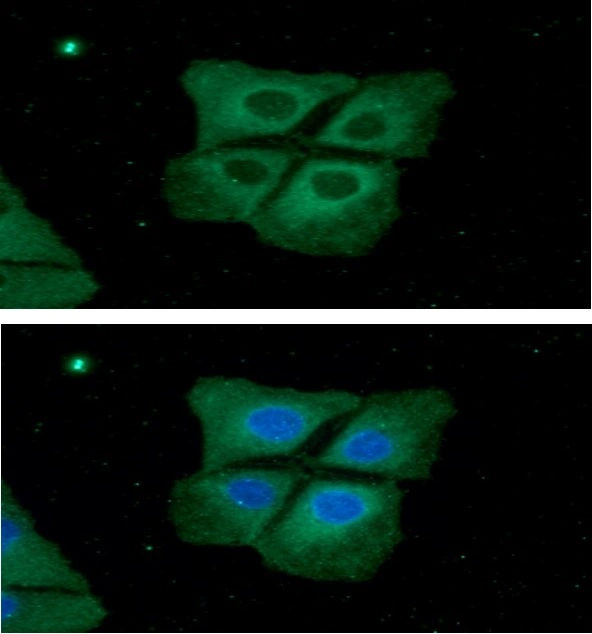 ICC/IF analysis of Hep3B cells using GTX57581 Pyruvate Kinase (liver/RBC) antibody. Blue: DAPI Green: Primary antibody Dilution: 1:100