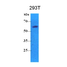 WB analysis of 293T whole cell lysate using GTX57581 Pyruvate Kinase (liver/RBC) antibody. Loading : 40 microg Dilution : 1:500