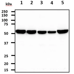 WB analysis of various samples using GTX57581 Pyruvate Kinase (liver/RBC) antibody. Lane 1 : Balb/3T3 whole cell lysate Lane 2 : HeLa whole cell lysate Lane 3 : Raji whole cell lysate Lane 4 : K562 whole cell lysate Lane 5 : A549 whole cell lysate Loading : 40 microg Dilution : 1:500
