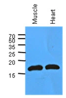 WB analysis of various samples using GTX57584 Myoglobin antibody. Samples : Mouse muscle and heart tissue lysate Loading : 40 microg Dilution : 1:1000 WB analysis of various samples using GTX57584 Myoglobin antibody. Samples : Mouse muscle and heart tissue lysate Loading : 40 microg Dilution : 1:1000