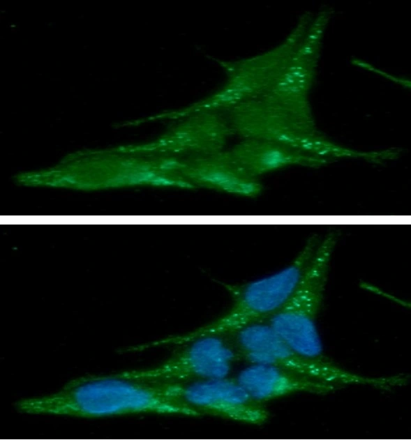 ICC/IF analysis of LNCaP cells using GTX57587 alpha Synuclein antibody. Blue: DAPI Green: Primary antibody Dilution: 1:100
