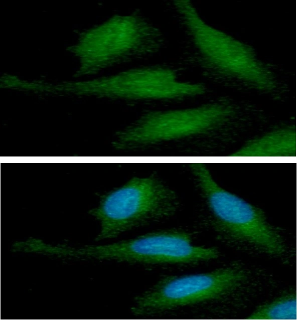 ICC/IF analysis of HeLa cells using GTX57587 alpha Synuclein antibody. Blue: DAPI Green: Primary antibody Dilution: 1:100 ICC/IF analysis of HeLa cells using GTX57587 alpha Synuclein antibody. Blue: DAPI Green: Primary antibody Dilution: 1:100