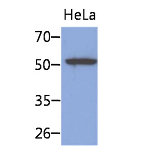 WB analysis of HeLa whole cell lysate using GTX57589 Cytokeratin 8 antibody. Loading : 40 microg Dilution : 1:1000