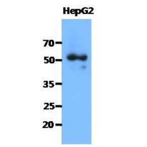 WB analysis of HepG2 whole cell lysate using GTX57590 Syntrophin alpha 1 antibody. Loading : 40 microg Dilution : 1:1000