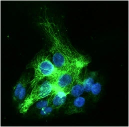 ICC/IF analysis of HepG2 cells using GTX57591 Cytokeratin 19 antibody. Blue: DAPI Green: Primary antibody Dilution: 1:100