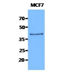WB analysis of MCF-7 whole cell lysate using GTX57591 Cytokeratin 19 antibody. Loading : 40 microg Dilution : 1:1000
