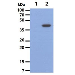 WB analysis of various samples using GTX57591 Cytokeratin 19 antibody. Lane 1 : 293T cell lysate Lane 2 : KRT19 transfected 293T cell lysate Loading : 5 microg Dilution : 1:1000
