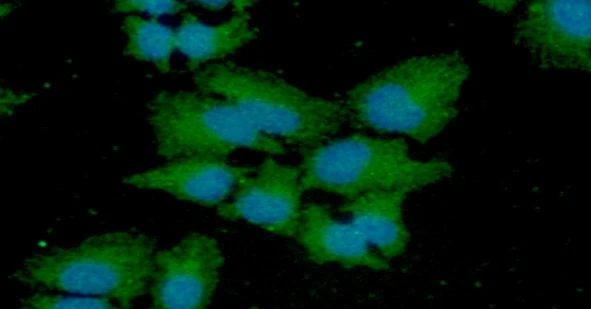 ICC/IF analysis of HeLa cells using GTX57592 Cathepsin S antibody. Blue: DAPI Green: Primary antibody Dilution: 1:100 ICC/IF analysis of HeLa cells using GTX57592 Cathepsin S antibody. Blue: DAPI Green: Primary antibody Dilution: 1:100