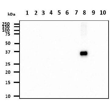 WB analysis of various samples using GTX57592 Cathepsin S antibody. Lane 1 : Recombinant Human CTSB protein Lane 2 : Recombinant Human CTSD protein Lane 3 : Recombinant Human CTSE protein Lane 4 : Recombinant Human CTSF protein Lane 5 : Recombinant Human CTSH protein Lane 6 : Recombinant Human CTSK protein Lane 7 : Recombinant Human CTSL protein Lane 8 : Recombinant Human CTSS protein Lane 9 : Recombinant Human CTSW protein Lane 10 : Recombinant Human CTSZ protein Loading : 20 ng Dilution : 1:1000