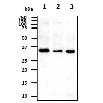 WB analysis of various samples using GTX57592 Cathepsin S antibody. Lane 1 : HeLa whole cell lysate Lane 2 : U87-MG whole cell lysate Lane 3 : A549 whole cell lysate Loading : 40 microg Dilution : 1:500
