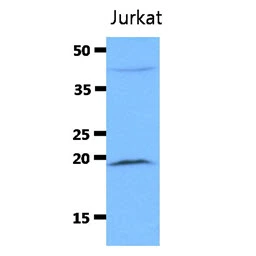 WB analysis of Jurkat whole cell lysate using GTX57593 Diablo antibody. Loading : 40 microg Dilution : 1:3000