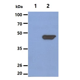 WB analysis of various samples using GTX57594 NSE antibody. Lane 1 : 293T cell lysate Lane 2 : NSE transfected 293T cell lysate Loading : 5 microg Dilution : 1:1000