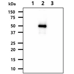 WB analysis of various samples using GTX57594 NSE antibody. Lane 1 : Recombinant Human ENO1 protein Lane 2 : Recombinant Human NSE (ENO2) protein Lane 3 : Recombinant Human ENO3 protein Loading : 50 ng Dilution : 1:1000
