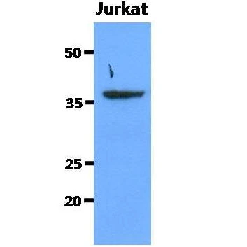 WB analysis of Jurkat whole cell lysate using GTX57595 SORD antibody. Loading : 40 microg Dilution : 1:1000