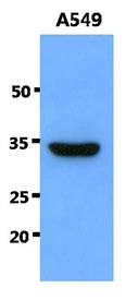WB analysis of A549 whole cell lysate using GTX57596 SNAI1 antibody. Loading : 40 microg Dilution : 1:1000 WB analysis of A549 whole cell lysate using GTX57596 SNAI1 antibody. Loading : 40 microg Dilution : 1:1000